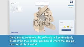 ioConnect: Step by Step User Guide for Accurate Dental Implant Location
