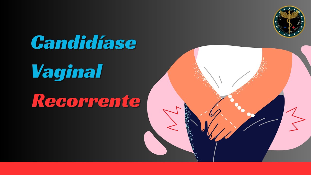 Como tratar candidíase vaginal recorrente? - Renato Cassol Médico Infectologista