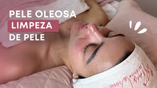 Skin Cleansing for Oily Skin