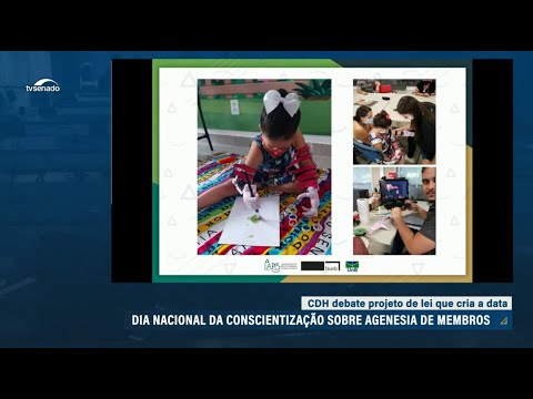 Saiba o que é a agenesia de membros e por que se pretende criar um dia de conscientização sobre ela