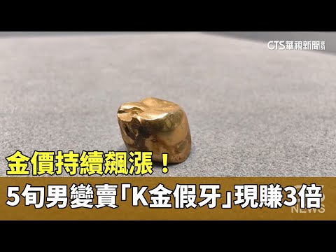 金價持續飆漲！　5旬男變賣「K金假牙」現賺3倍