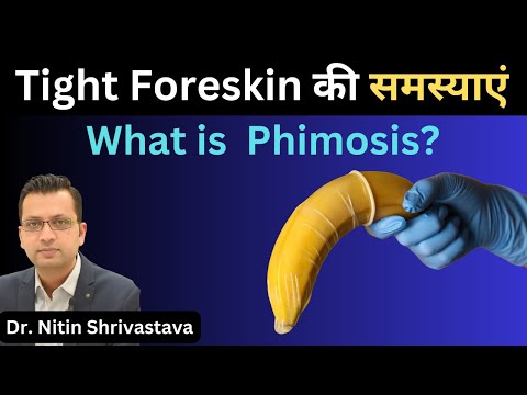 Phimosis (Tight Foreskin) - Causes, Complications, and Treatment