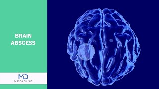 Brain Abscesses: Symptoms, Causes, and Treatment
