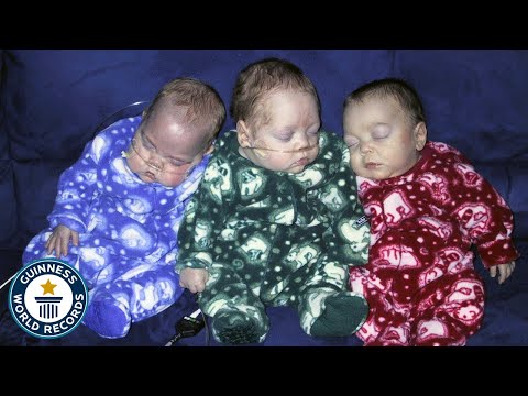 Our Triplets Were Born 17 Days Apart - Guinness World Records
