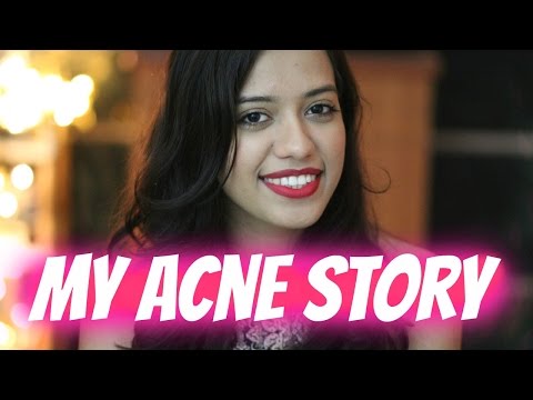My Acne Story | Debasree Banerjee Video