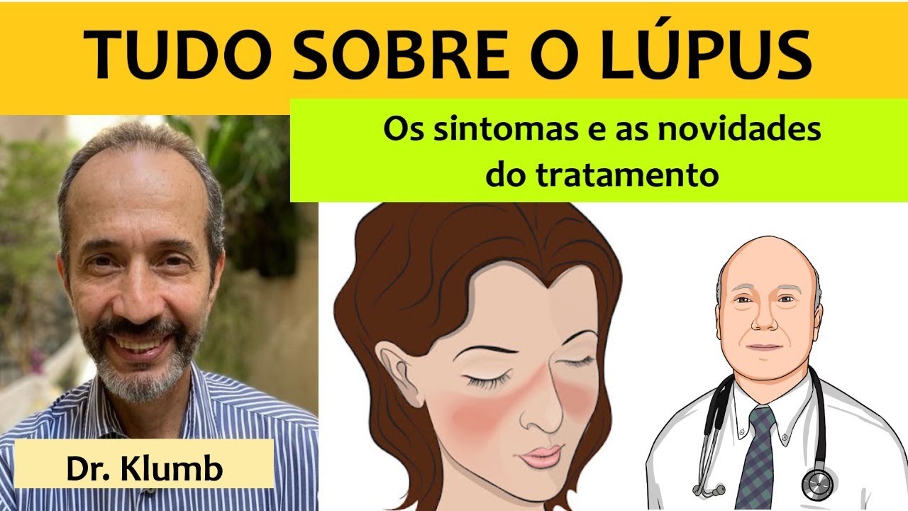 O que é lúpus sistêmico: causa, sintomas e tratamento