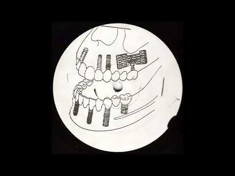 Major Problems - Gingivitis [Lenny Dee + Ralphie Dee] [1991 Nu Groove]