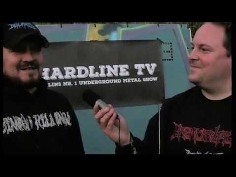 Hardline TV: Interview with Serge Gordeev (Epicardiectomy)