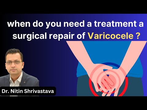 Varicocele Surgery - When Is Treatment Actually Needed?