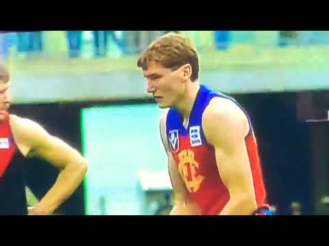 1986 Elimination Final-Fitzroy V Essendon. Smack in the face!