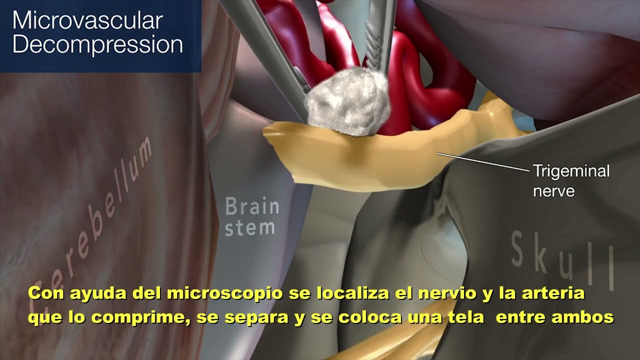 José María Hernández Garcia-6