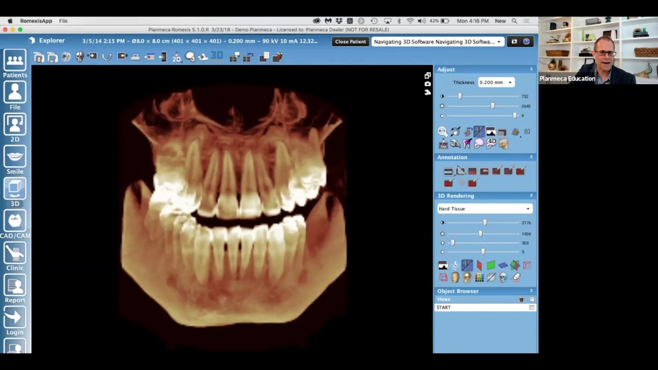 3D Imaging Software: Navigating in a 3D Space