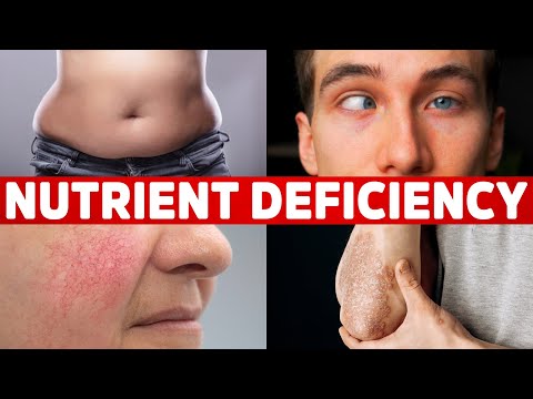 Yellow Bumpy Patches Around the Eyelids