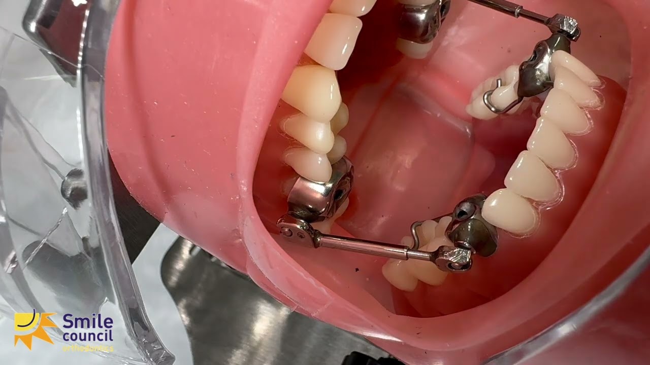 Herbst Bite Jumper