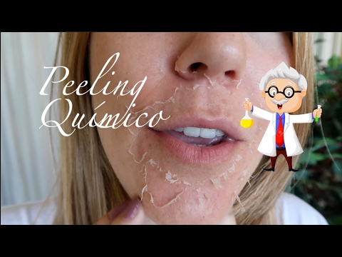 download lagu mp3 mp4 Green Peeling Casero, download lagu Green Peeling Casero gratis, unduh video klip Green Peeling Casero