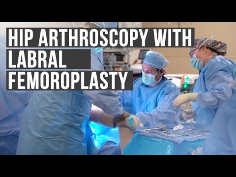 Hip Arthroscopy with Labral Femoroplasty