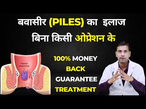 What is Piles? Causes, Symptoms and Treatment | Bawaseer Ka ilaj | बवासीर के मस्सों का इलाज