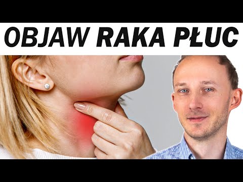 Takie są (pierwsze?) objawy RAKA PŁUC i co go powoduje