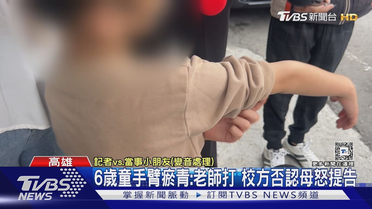 6歲童手臂瘀青:老師打 校方否認母怒提告