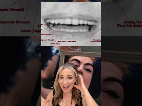 Joan Crawford's Cheekbone Transformation: Teeth Pulled? #shorts