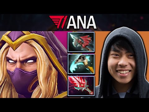 Invoker Dota 2 Gameplay T1.Ana with Vyse and Malevolence - 17 Kills #dota2 #dota2gameplay