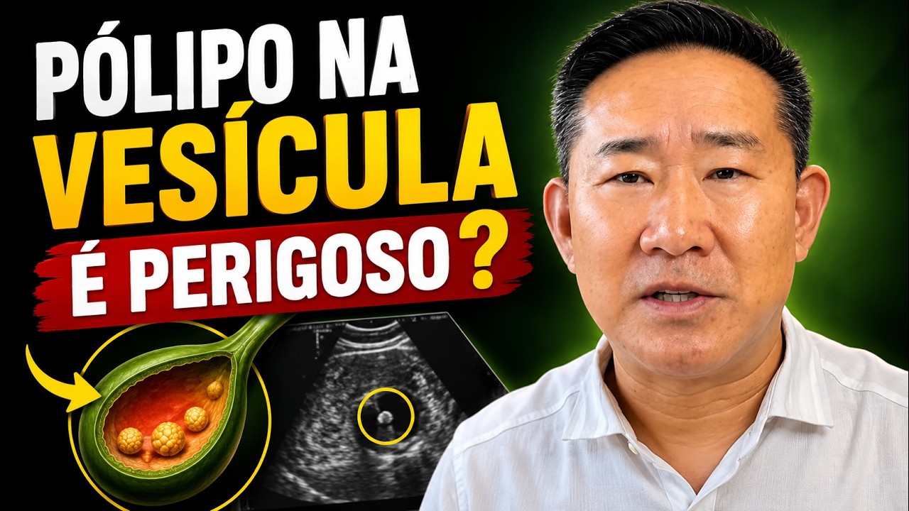 QUANDO O PÓLIPO NA VESÍCULA PREOCUPA? | Peter Liu