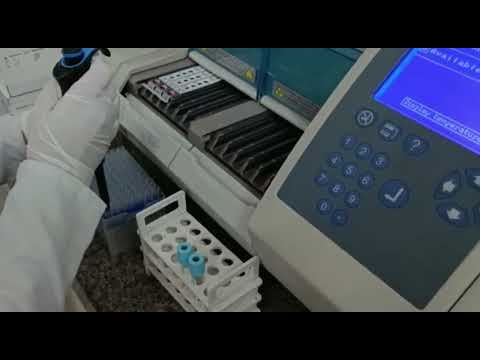 D - dimer test on Mini Vidas |Biochemistry