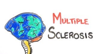 Multiple Sclerosis