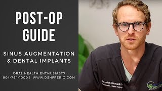 Download Lagu Post-Operative Guide To Sinus Lift Surgery | Dr. John W. Thousand IV Thumbnail