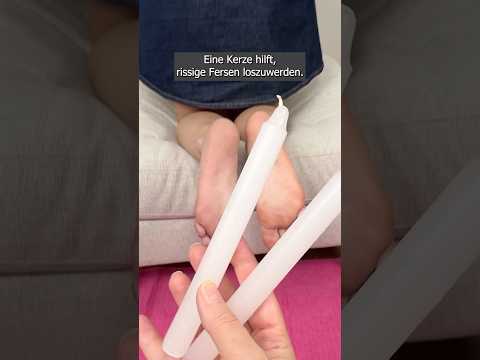 I got rid of cracked heel skin with a regular candle