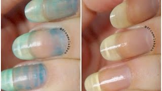 How to remove serious nail stains!