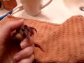 Are Hermit Crab Mites Harmful To Humans