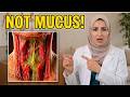 Mucus In Your Throat Every Day What No One Tells You About This Hidden Cause