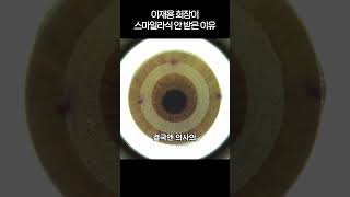[강남밝은미소안과] 채널A 닥터지바고 - 눈에 좋은 음식 마리골드(금잔화) (문현승 원장님 방송출연)