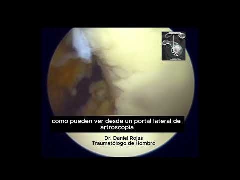 Daniel Rojas Castillo-39