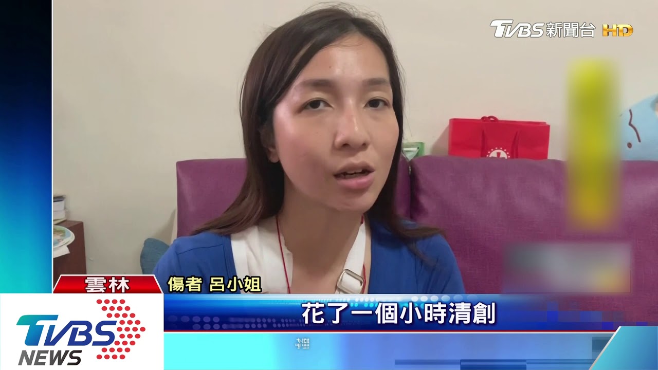 禮儀師控醫疏忽 鎖骨骨折5天動刀2次