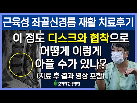 치료후기사진 입니다.