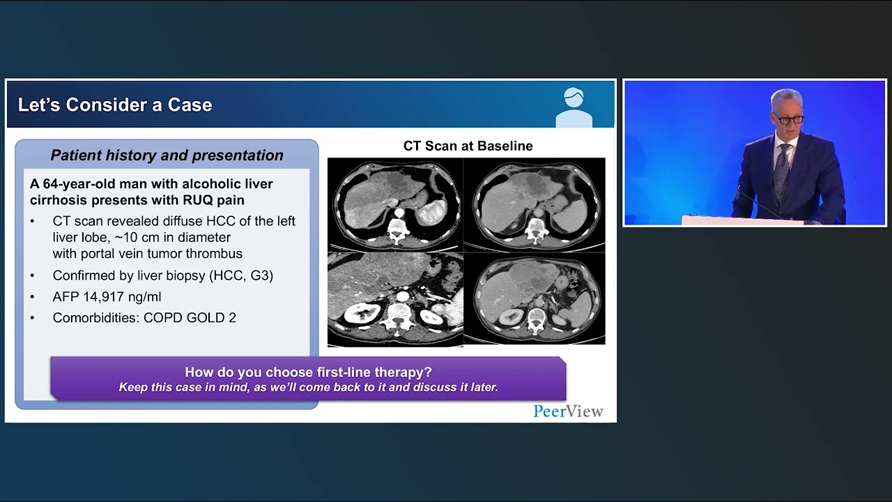 Purpose in Practice for Hepatocellular Carcinoma