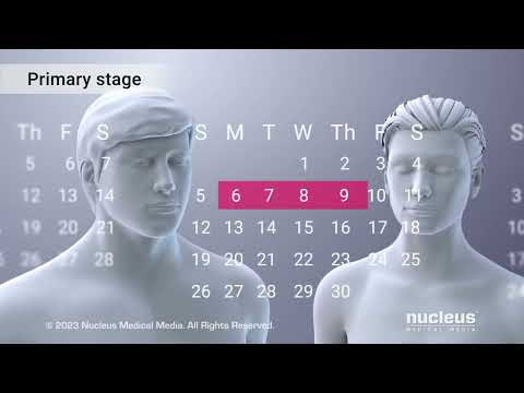 STDs: What is Syphilis?