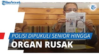 Diduga Dikeroyok Senior, Organ Polisi Muda Rusak Berat hingga Harus Operasi 2 Kali