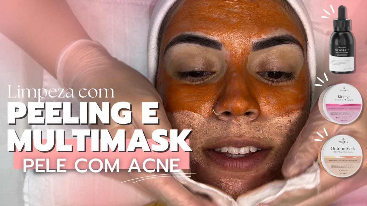 LIMPEZA DE PELE EM PELE ACNEICA - COM TULÍPIA