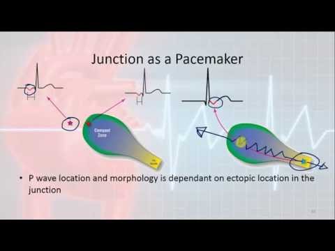 Basic Electrophysiology, part 8 - Junctional Rhythms