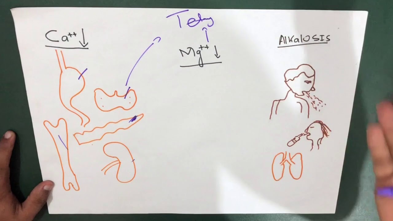 Tetany | Causes | Signs | Treatment - YouTube