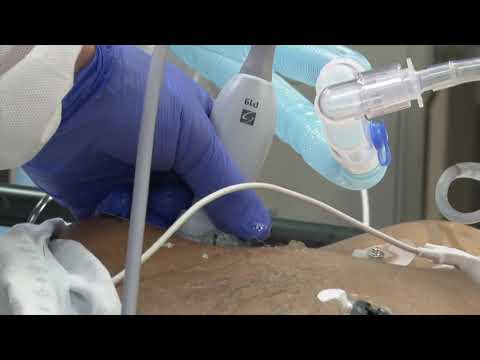 Tri-State Covid Latest