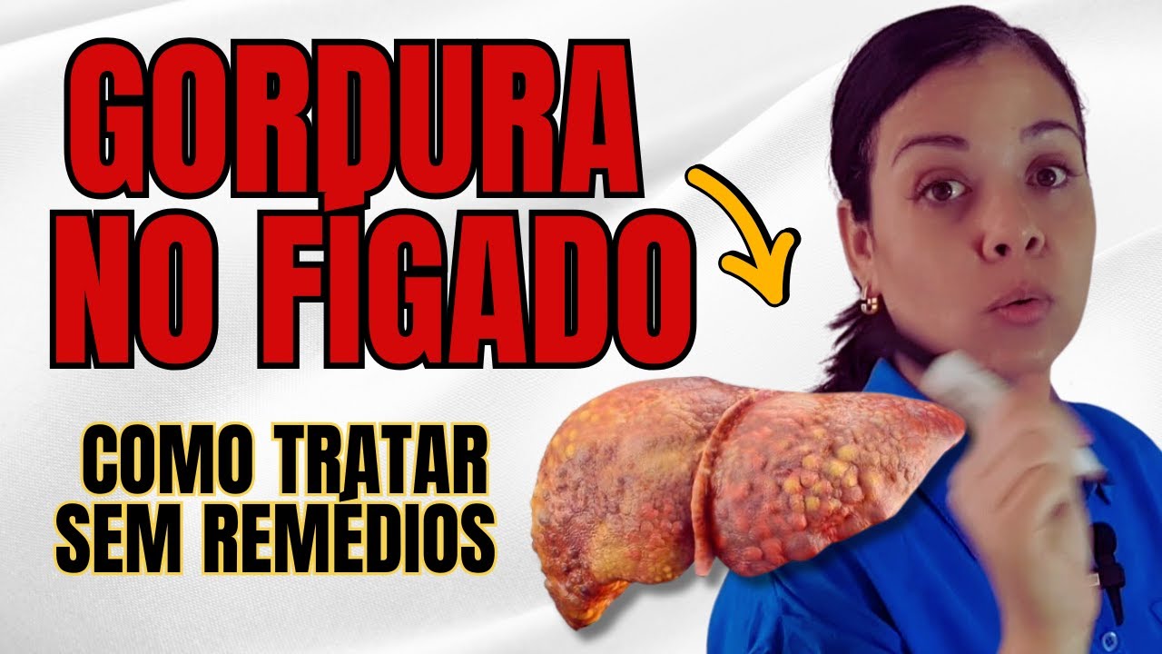 4 Passos simples para tratar gordura no fígado SEM REMÉDIOS.