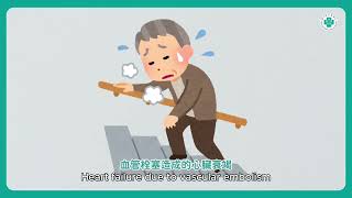 心臟功能剩不到兩成！長效型輔助器神救援│吳詠斯醫師