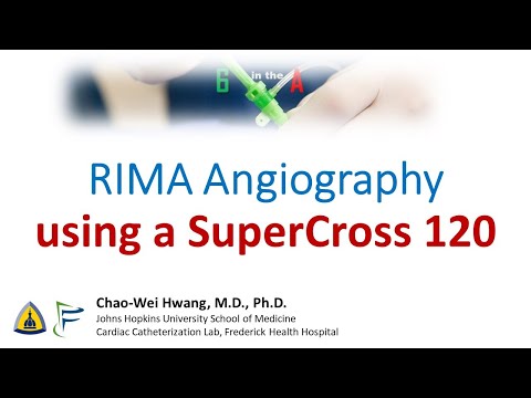 RIMA Angiography using SuperCross angled microcatheter