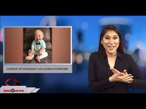 Gerber spokesbaby has down syndrome (ASL - 2.8.18)