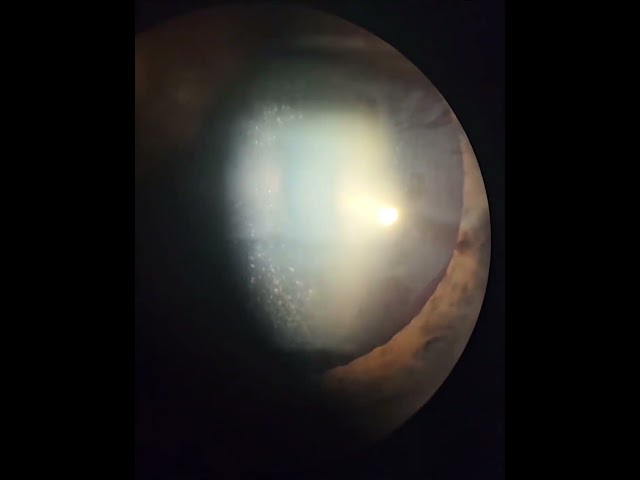 Vídeo