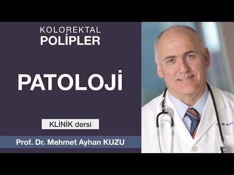 Kolorektal Polipler - Patoloji